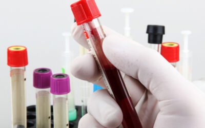 Todo Lo Que Necesitas Saber Sobre la Homocisteína y Tu Salud